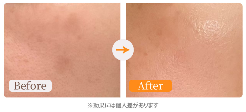 シミが薄くなった